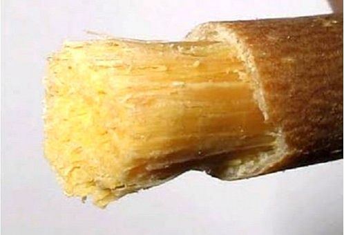 牙刷(牙膏)的树图示 牙刷(牙膏)的树图示